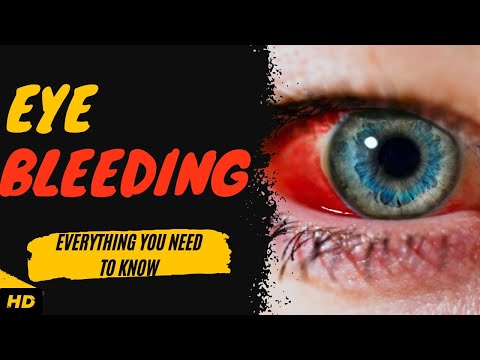 Eye Bleeding: Everything You Need To Know