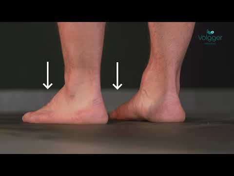 Übung bei Knicksenkplatt- und Spreizfuß & Hallux-Valgus - "Fuß Brücke"