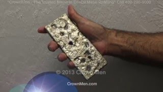 Dental | 402-290-9000 | Scrap | Selling | Refinery | Buyer | Metal | Gold | Crown Men | 123