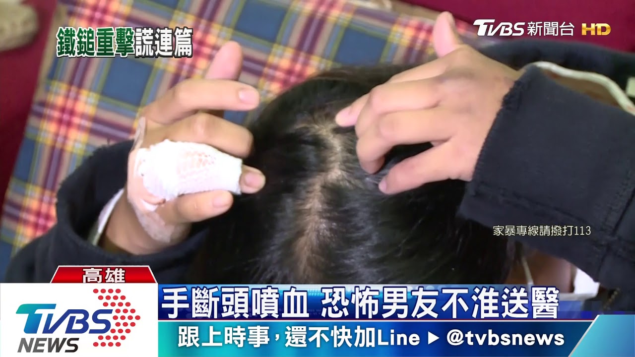 不滿催促！　前男友持鐵鎚海K女渾身傷
