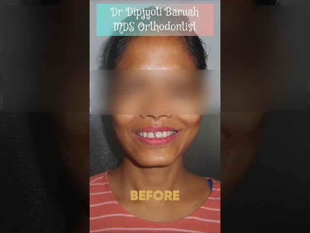 Thumbnail for Post ID: q_qv6p7y0D8