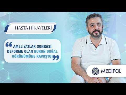 Nefes Alma Problemi ve Burun Deformitesinde Revizyon Rinoplasti Süreci | Nurol Bey'in Hikayesi