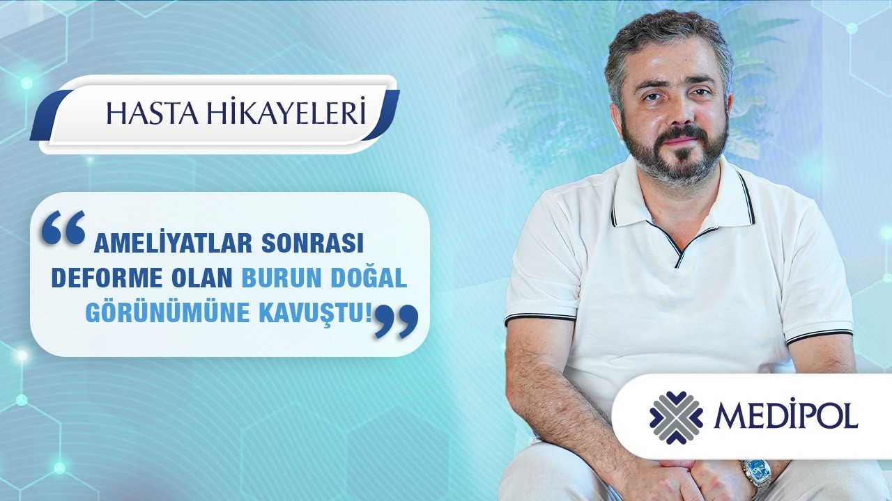 Nefes Alma Problemi ve Burun Deformitesinde Revizyon Rinoplasti Süreci | Nurol Bey'in Hikayesi