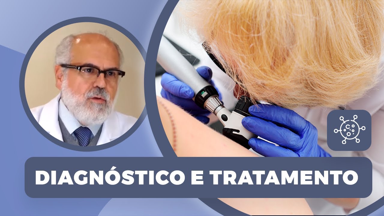Câncer de pele | Diagnóstico e tratamento