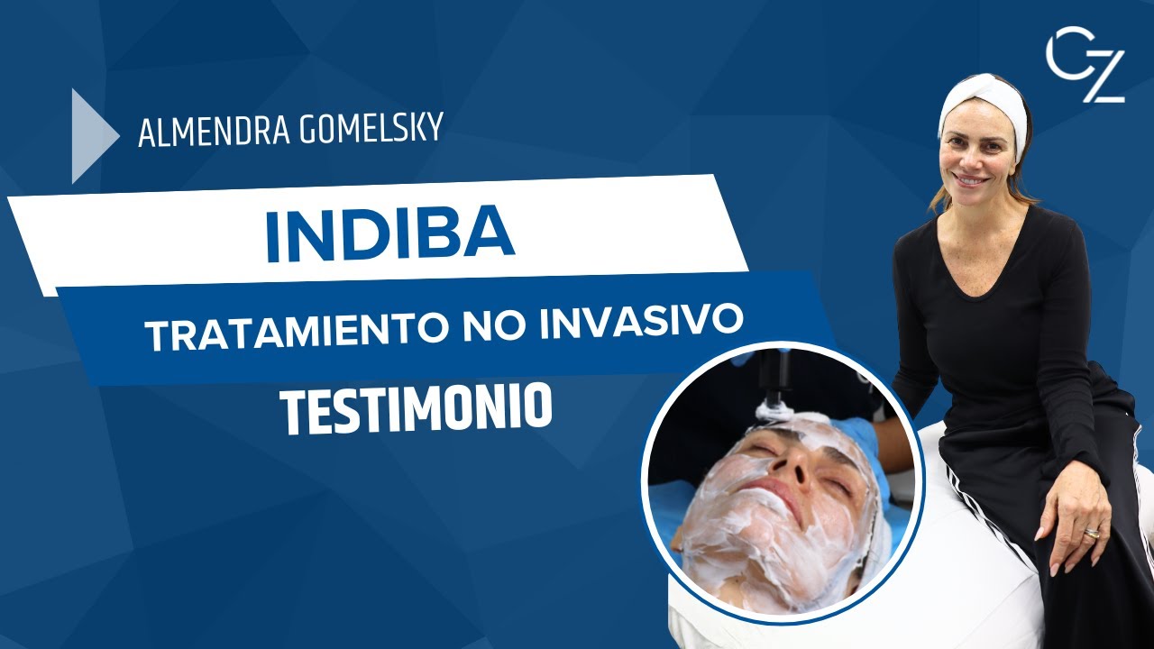 Otto Enrique Ziegler Gutierrez-12