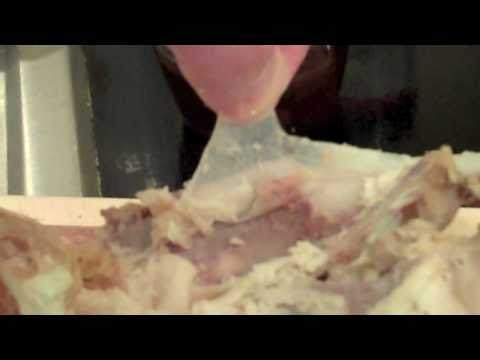 What is Fascia and Connective Tissue? The vital role fascial & connective tissue