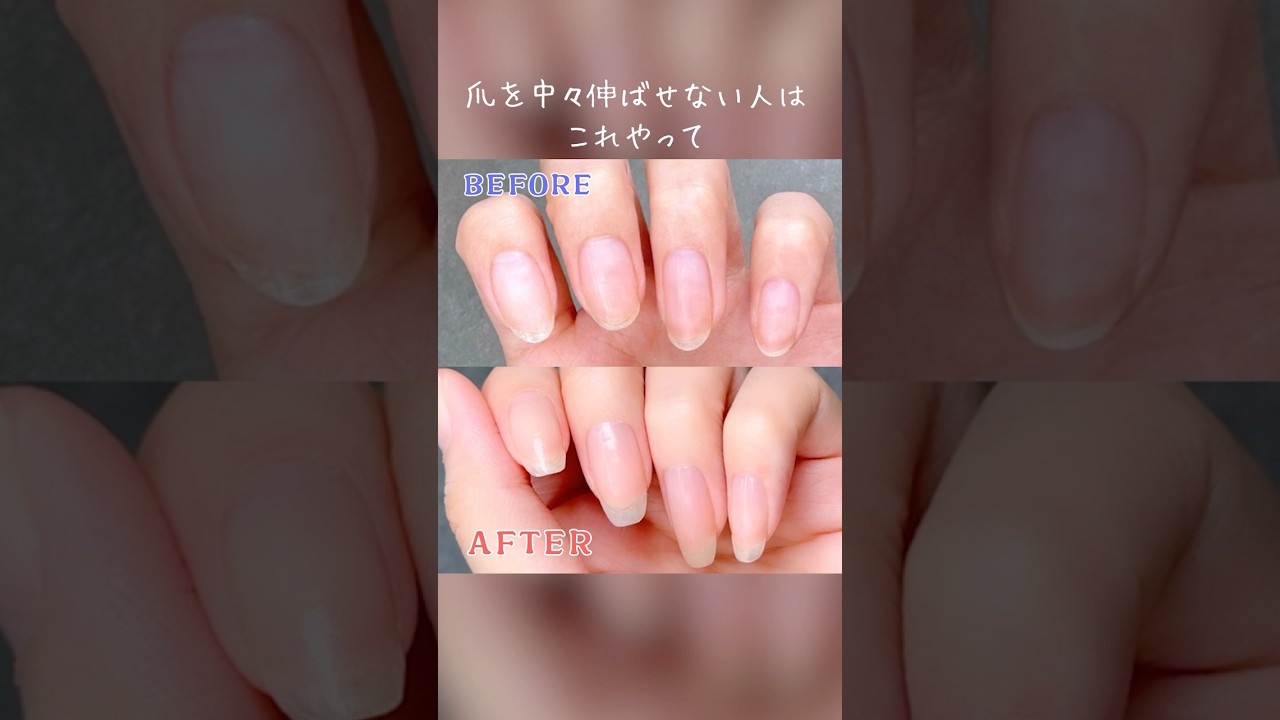 これだけすれば爪をキレイに伸ばせる