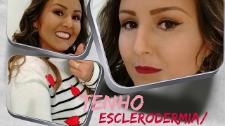 Minha História - Contando Sobre a Doença Esclerodermia/ Esclerose Sistêmica