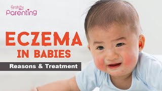 Baby Eczema - Causes, Signs and Treatment