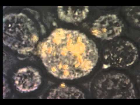 Ученые создают наноскопических внутриклеточных роботов-хирургов. Ученые создают наноскопических внутриклеточных роботов-хирургов. Фото.