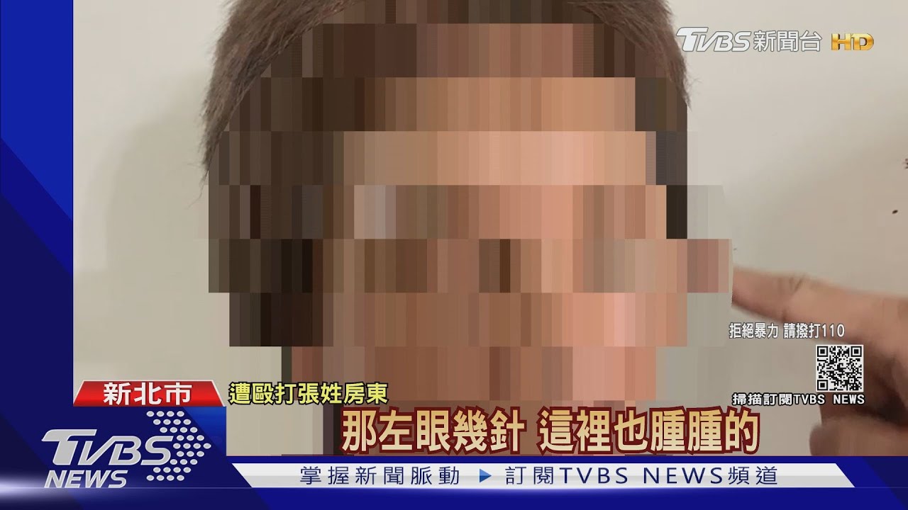 房東遭租客「打臉」濺血! 家屬控警「讓人跑」