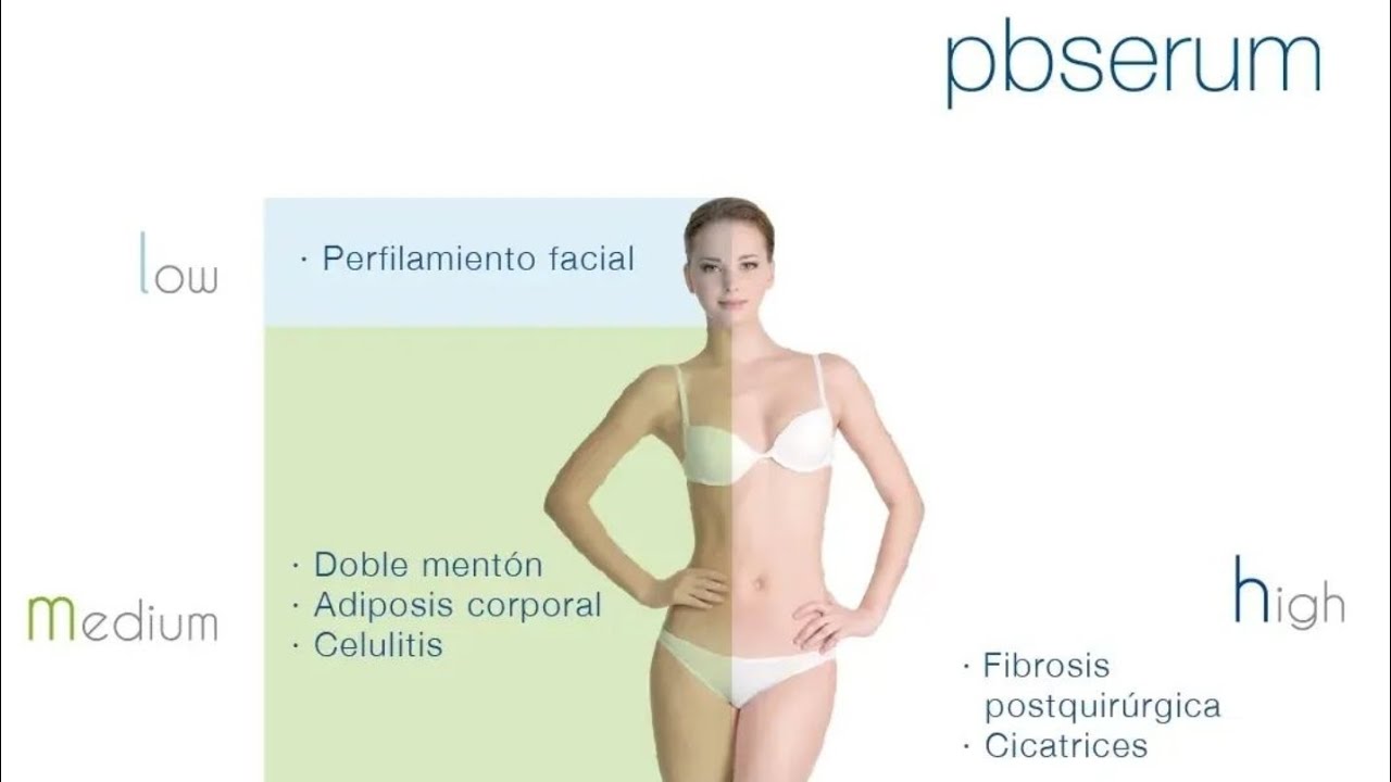 José Luis Muñoz Chapul-44