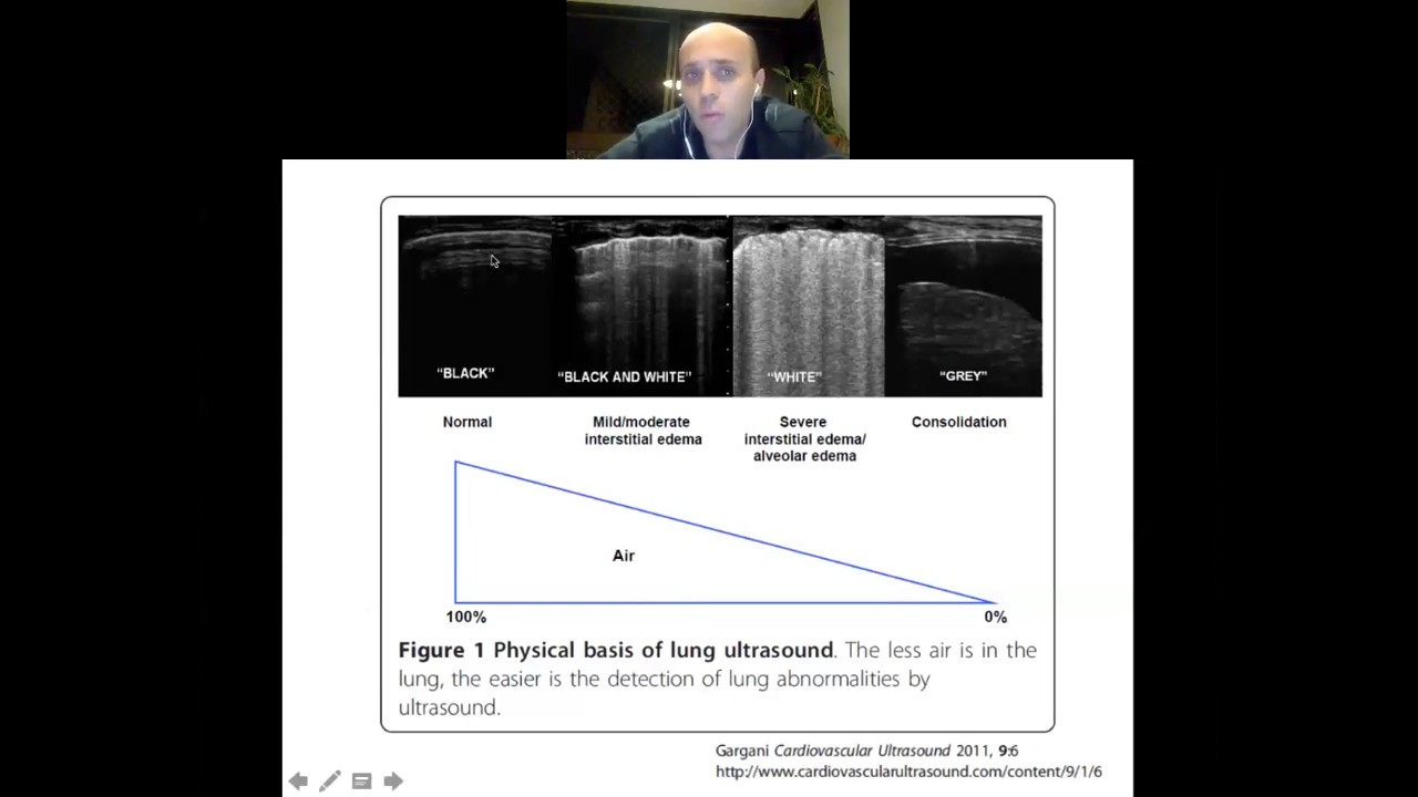 Ultrassom Pulmonar Essencial - Parte 1