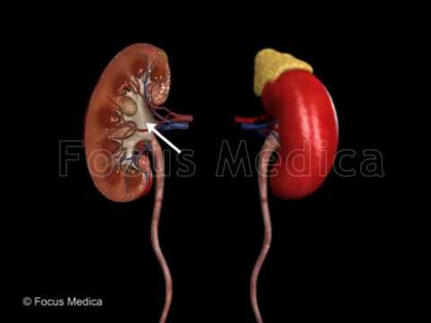 The Urinary Tract - Animated Atlas of BPH and OAB - YouTube