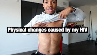 PHYSICAL CHANGES CAUSED BY MY HIV!