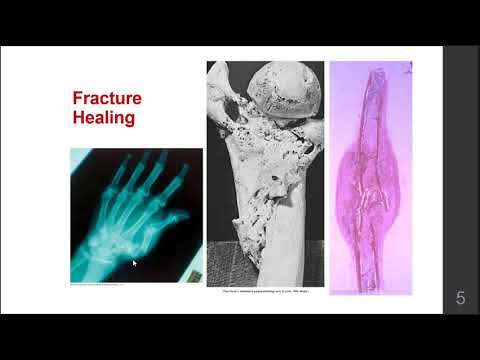 Musculoskeletal Disorders