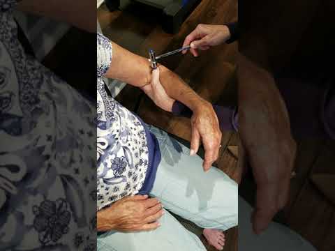 Video 5.33  Brachioradialis Tendon Reflex