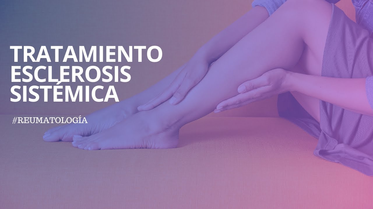 Tratamiento esclerosis sistémica