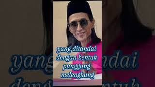 Download lagu Vokalis slam semakin mengkhawatirkan #gerimismengundang mp3
