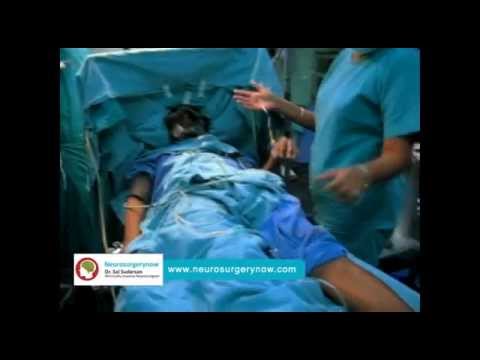 Deep Brain Stimulation Surgery in Hyderabad | Best Neurosurgeons in India