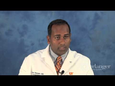 The relationship between AFIB and stroke