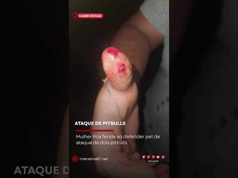 MULHER É MORDIDA AO TENTAR PROTEGER CACHORRO DE ATAQUE DE PITBULLS #cabeceirasgo
