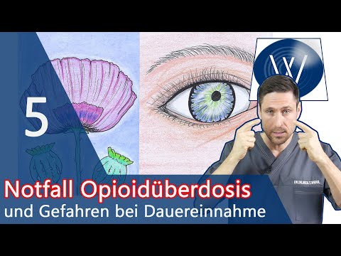 Opioidvergiftung durch Tilidin, Oxycodon & Co: Achten Sie auf diese Warnzeichen einer Überdosierung!