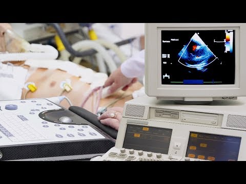 Understanding Abdominal Aortic Aneurysms