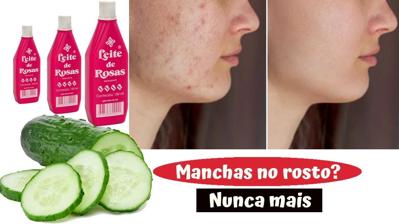 SEM Manchas , pele lisa sem rugas e espinhas 15 ANOS MAIS NOVA !!!