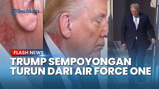 Jadi Sorotan! Donald Trump Sempoyongan Turun dari Air Force One dan Kesulitan Duduk, Ada Apa?