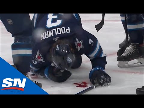 Tucker Poolman blocks a wrist shot with his face vs Flames