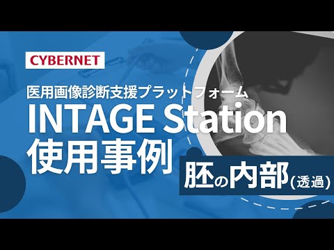 自然なプライバシー スクリーンを再現したい場合、死んだトゥジャを何で置き換えることができますか?あなたのための5つのオプション  庭園