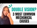 What are the 3 most common mechanical causes of double vision? 👀 👀