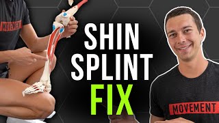 The REAL Cause of Shin Splints and How to Fix IT