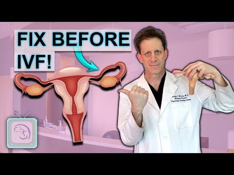 Blocked Tubes How to Avoid IVF and Surgery Fertility Expert Dr Randy Morris