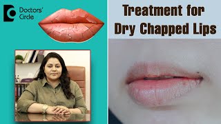 Heal Chapped Lips Fast with these 4 Simple Remedies  - Dr. Tina Ramachander | Doctors