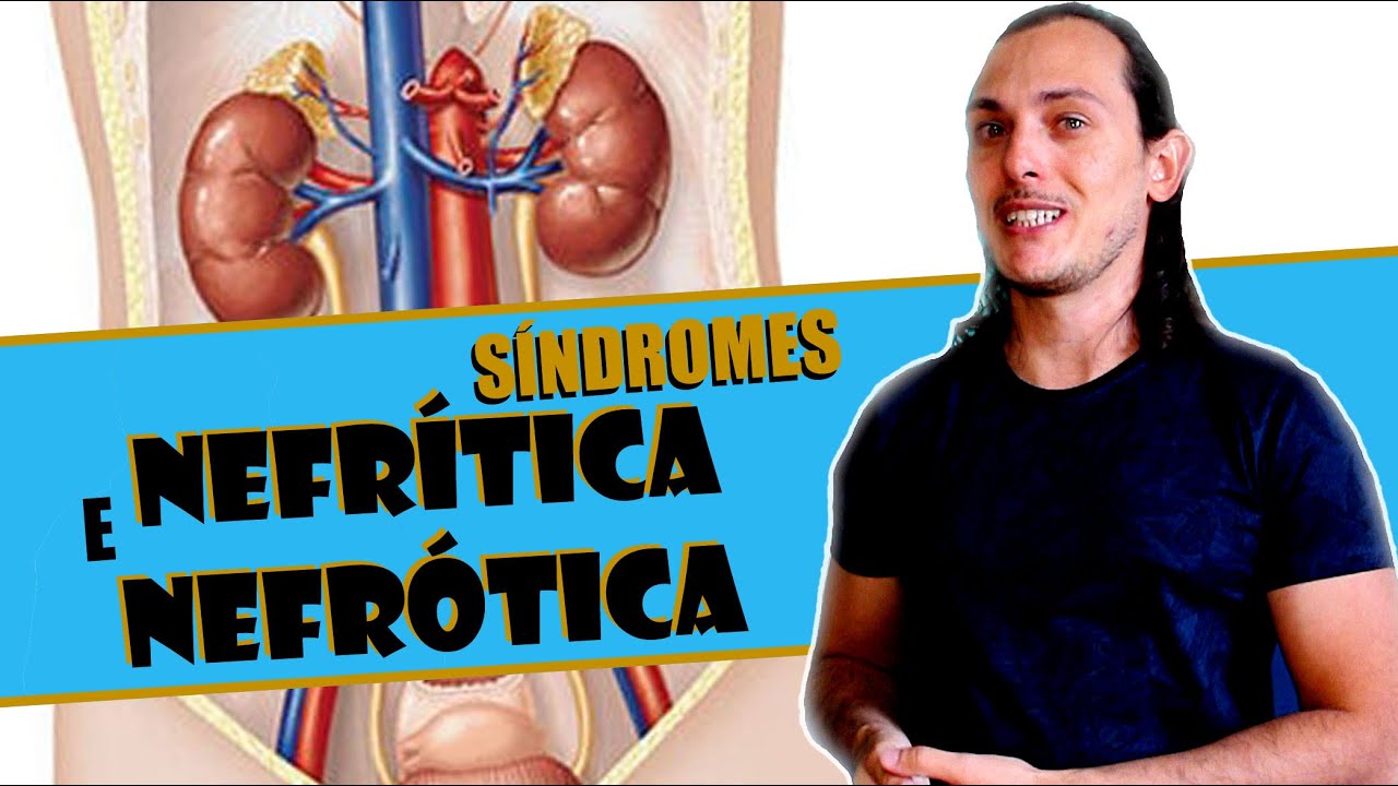 Patologia humana: Síndrome Nefrítica e Nefrótica