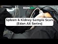 Spleen and Kidney Ultrasound Demo Scan (Edan/Acclarix AX Series)