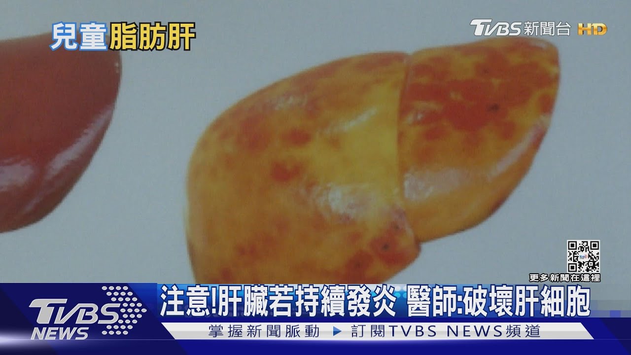 有片/孩童罹患「這疾病」多數無症狀不注意! 小心罹癌風險