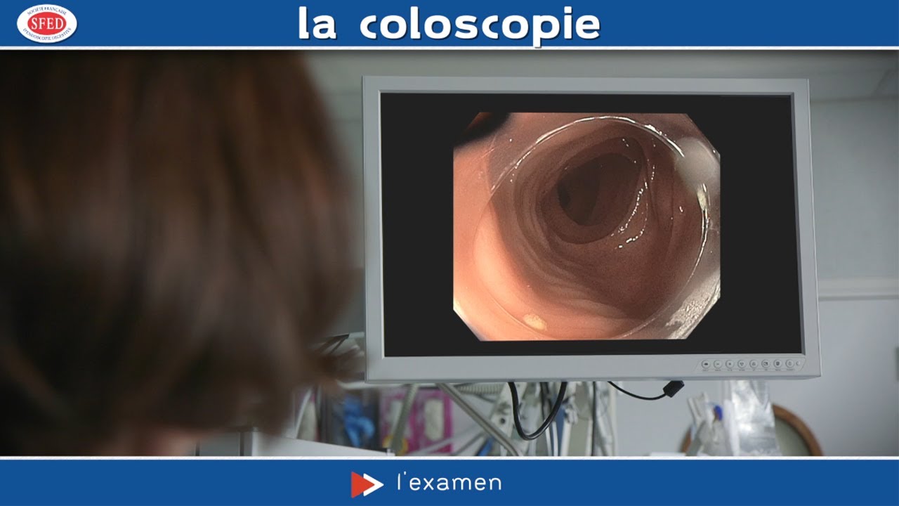 La coloscopie (film à destination des patients)