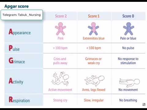 درجات ابجار APGAR SCORE