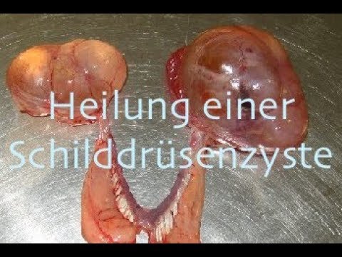 Schmerzen Schmerzen vor der Menstruation Ursachen Nicht ACHED Creme zu unterstützen