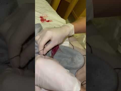 THIS IS HOW TO  CUT KITTEN'S UMBILICAL CORD