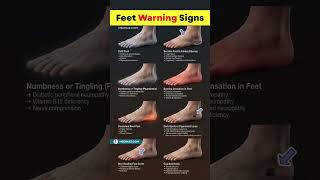 What Your Feet May Be Telling You About Your Health 🦶🏻