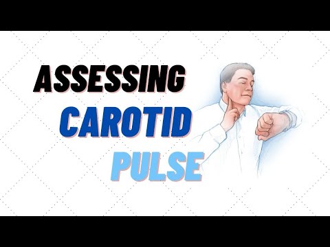 How to find and assess carotid pulse rate