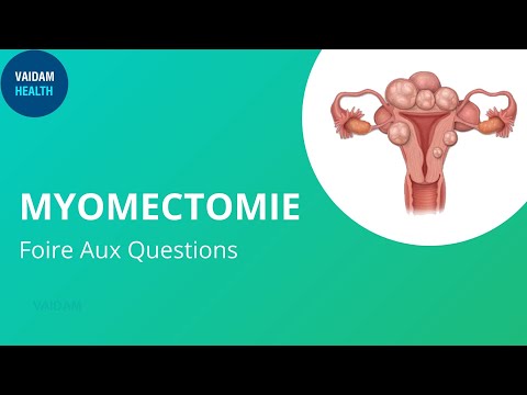 MYOMECTOMIE