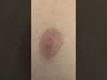 Nip Slip Clip