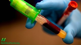 Normal Blood Lead Levels Can Be Toxic