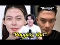 China’s Deadly “Bubble Forehead” Disaster