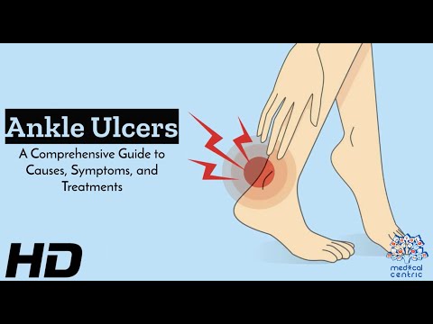 Effects of Cannabis on your body